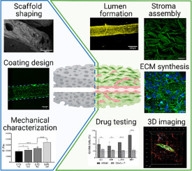 Fibroblasts mediate endothelium response to angiogenic cues in a newly ...